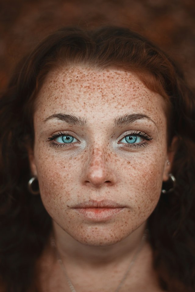 Pigmentation
